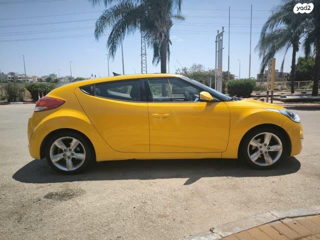 יונדאי ולוסטר