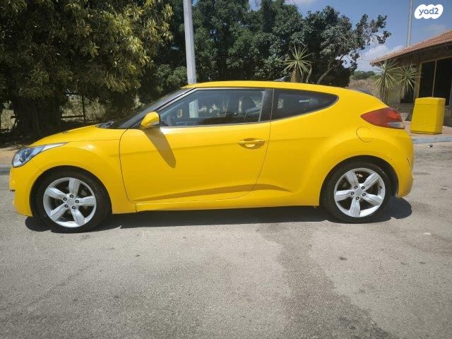 יונדאי ולוסטר