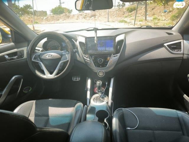 יונדאי ולוסטר