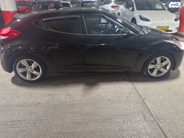 יונדאי ולוסטר