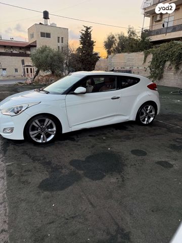 יונדאי ולוסטר