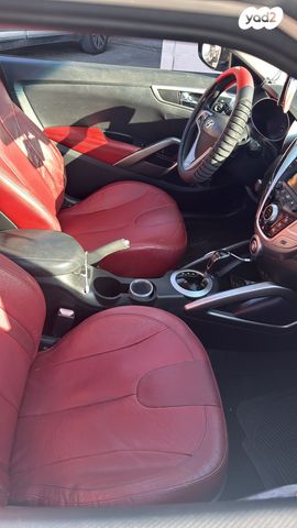 יונדאי ולוסטר