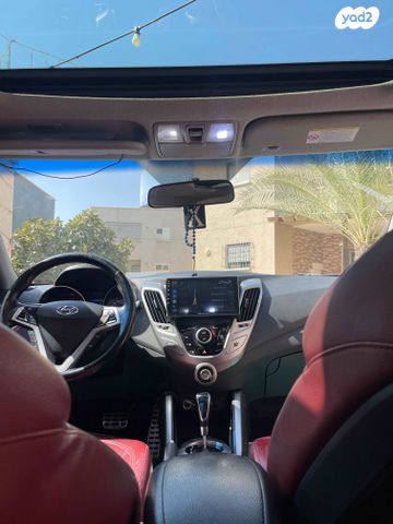 יונדאי ולוסטר