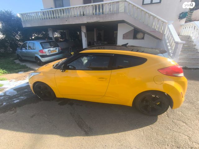 יונדאי ולוסטר