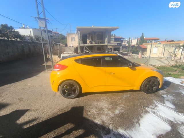 יונדאי ולוסטר