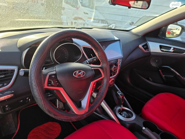 יונדאי ולוסטר