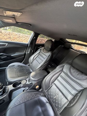 יונדאי ולוסטר