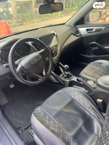 יונדאי ולוסטר