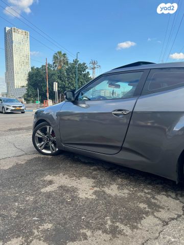 יונדאי ולוסטר