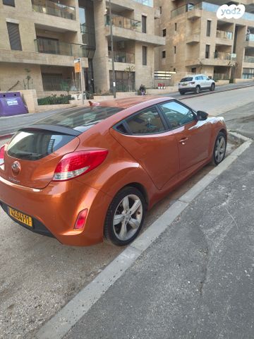 יונדאי ולוסטר