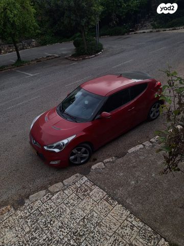 יונדאי ולוסטר