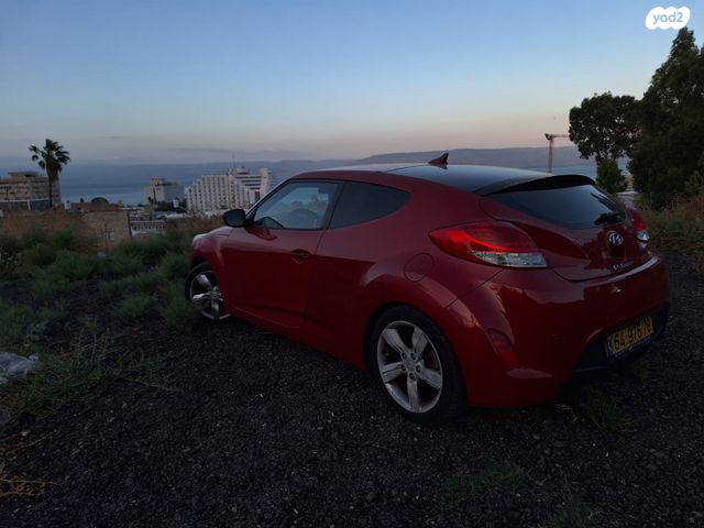 יונדאי ולוסטר