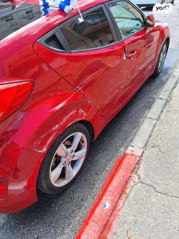 יונדאי ולוסטר