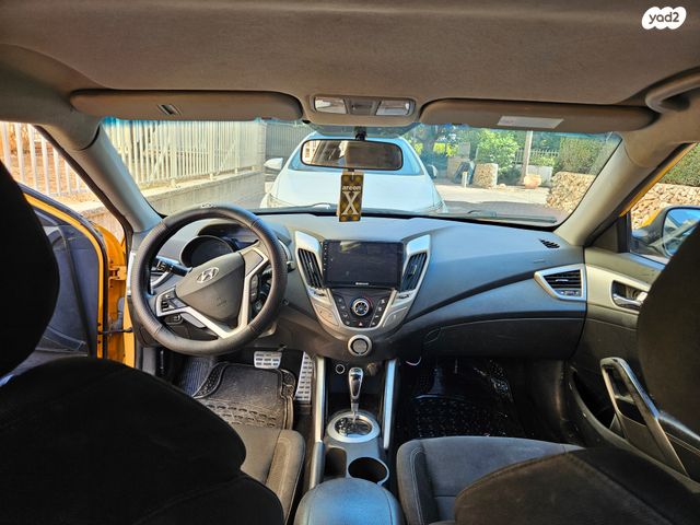 יונדאי ולוסטר