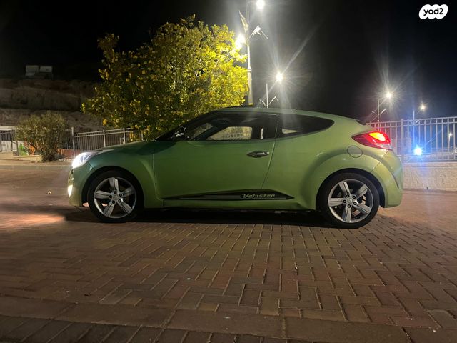 יונדאי ולוסטר