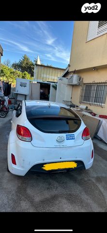 יונדאי ולוסטר