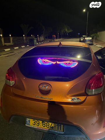 יונדאי ולוסטר