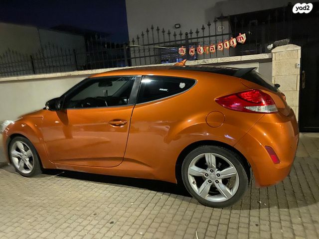 יונדאי ולוסטר