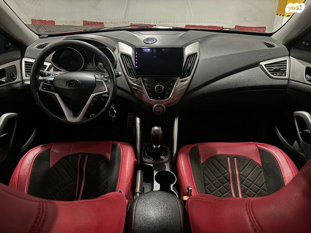 יונדאי ולוסטר