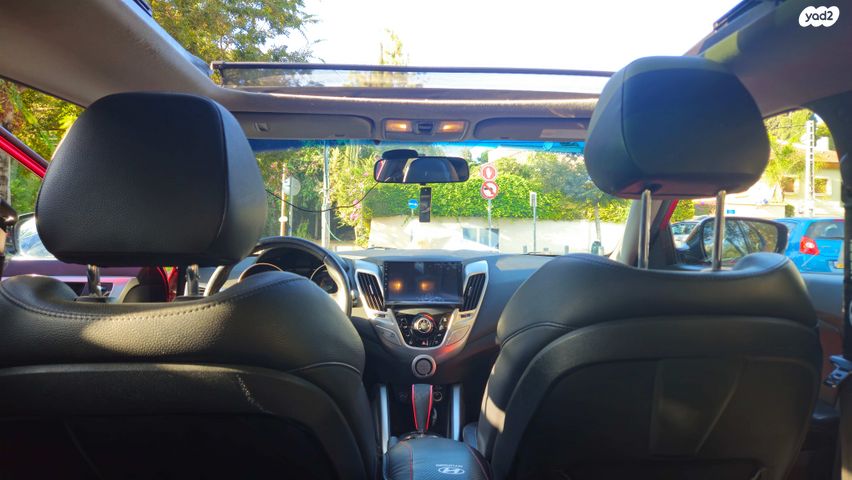 יונדאי ולוסטר