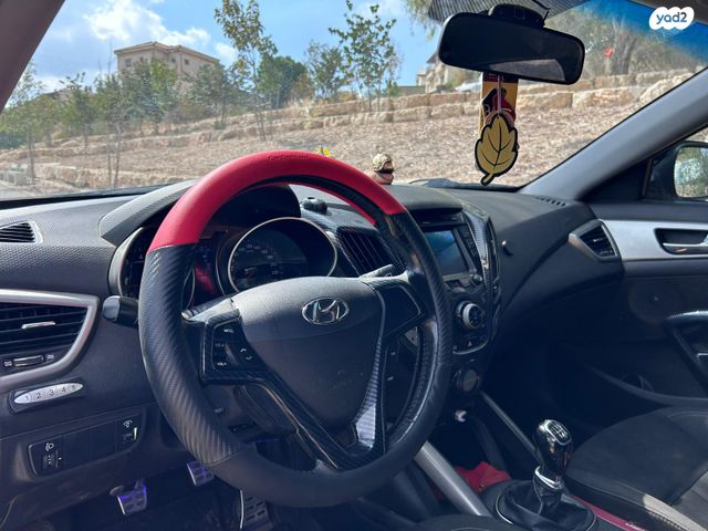 יונדאי ולוסטר