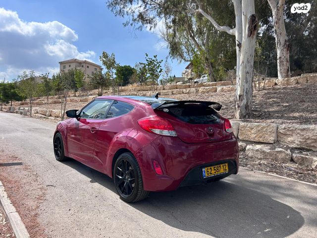 יונדאי ולוסטר