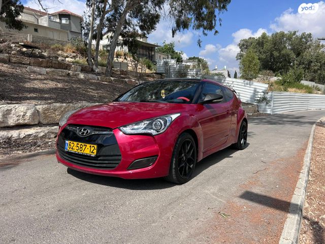 יונדאי ולוסטר