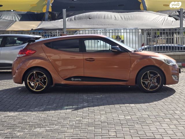 יונדאי ולוסטר