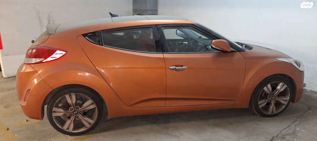 יונדאי ולוסטר