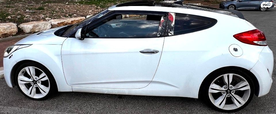 יונדאי ולוסטר