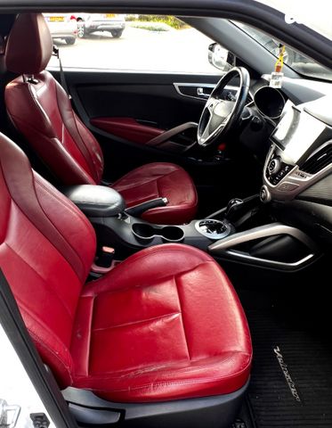 יונדאי ולוסטר