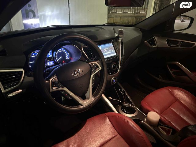 יונדאי ולוסטר