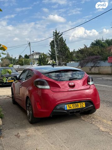 יונדאי ולוסטר