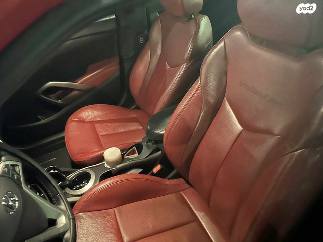 יונדאי ולוסטר