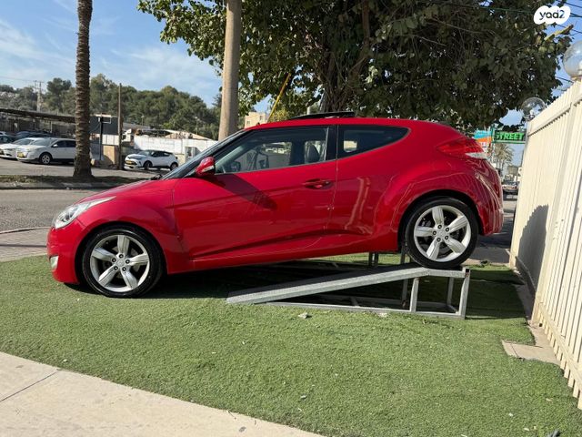 יונדאי ולוסטר