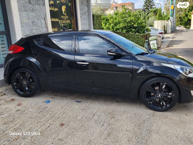 יונדאי ולוסטר