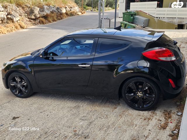 יונדאי ולוסטר