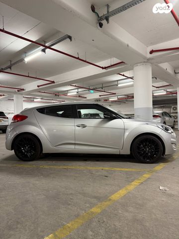 יונדאי ולוסטר