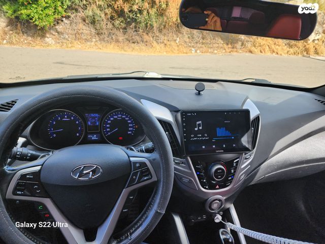 יונדאי ולוסטר